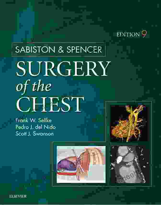 Sabiston And Spencer Surgery Of The Chest, Seventh Edition Sabiston And Spencer S Surgery Of The Chest: Expert Consult Online And Print (2 Volume Set) (Sabiston And Spencer Surgery Of The Chest)